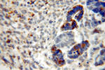 MLN64 Antibody in Immunohistochemistry (Paraffin) (IHC (P))