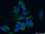 MLN64 Antibody in Immunocytochemistry (ICC/IF)