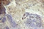 MLN64 Antibody in Immunohistochemistry (Paraffin) (IHC (P))