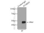MLN64 Antibody in Immunoprecipitation (IP)