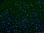 SLC6A8 Antibody in Immunohistochemistry (PFA fixed) (IHC (PFA))