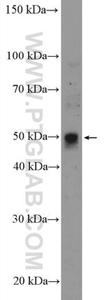 ANKH Antibody in Western Blot (WB)