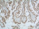 CD47 Antibody in Immunohistochemistry (Paraffin) (IHC (P))