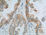 CD47 Antibody in Immunohistochemistry (Paraffin) (IHC (P))