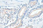 CD47 Antibody in Immunohistochemistry (Paraffin) (IHC (P))