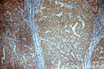 ELOVL2 Antibody in Immunohistochemistry (Paraffin) (IHC (P))