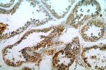 ELOVL2 Antibody in Immunohistochemistry (Paraffin) (IHC (P))