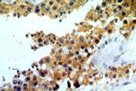 ELOVL2 Antibody in Immunohistochemistry (Paraffin) (IHC (P))