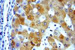 NDUFA9 Antibody in Immunohistochemistry (Paraffin) (IHC (P))