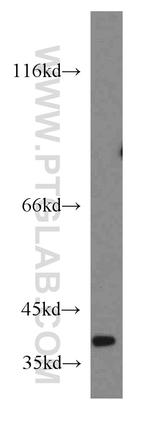 NDUFA9 Antibody in Western Blot (WB)