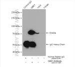 GBE1 Antibody in Immunoprecipitation (IP)