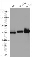 GBE1 Antibody in Western Blot (WB)