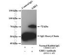 GBE1 Antibody in Western Blot (WB)