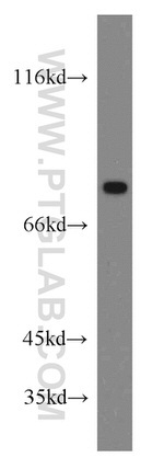 GBE1 Antibody in Western Blot (WB)