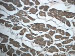 MEF2C Antibody in Immunohistochemistry (Paraffin) (IHC (P))