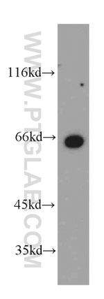 MEF2C Antibody in Western Blot (WB)