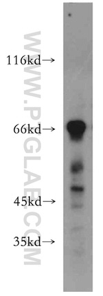 MEF2C Antibody in Western Blot (WB)