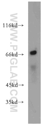 MEF2C Antibody in Western Blot (WB)