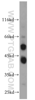 B4GALT2 Antibody in Western Blot (WB)