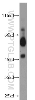 B4GALT2 Antibody in Western Blot (WB)