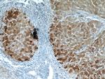 LTBR Antibody in Immunohistochemistry (Paraffin) (IHC (P))