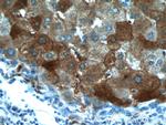 LTBR Antibody in Immunohistochemistry (Paraffin) (IHC (P))