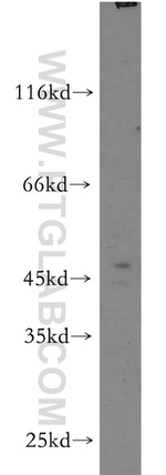 LTBR Antibody in Western Blot (WB)