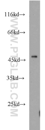 LTBR Antibody in Western Blot (WB)