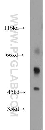 LTBR Antibody in Western Blot (WB)