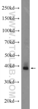 Adenosine A1 Receptor Antibody in Western Blot (WB)