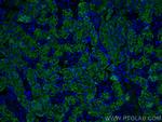 AQP1 Antibody in Immunohistochemistry (PFA fixed) (IHC (PFA))