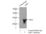 AQP1 Antibody in Immunoprecipitation (IP)