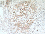 YBX1 Antibody in Immunohistochemistry (Paraffin) (IHC (P))