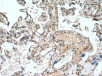 YBX1 Antibody in Immunohistochemistry (Paraffin) (IHC (P))