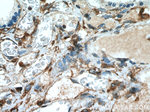 YBX1 Antibody in Immunohistochemistry (Paraffin) (IHC (P))