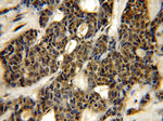 YBX1 Antibody in Immunohistochemistry (Paraffin) (IHC (P))