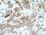 YBX1 Antibody in Immunohistochemistry (Paraffin) (IHC (P))