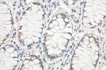 YBX1 Antibody in Immunohistochemistry (Paraffin) (IHC (P))