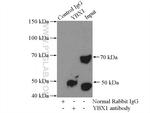 YBX1 Antibody in Immunoprecipitation (IP)