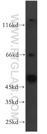 YBX1 Antibody in Western Blot (WB)