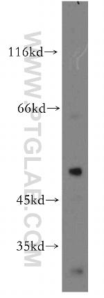 YBX1 Antibody in Western Blot (WB)