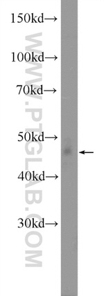 YBX1 Antibody in Western Blot (WB)