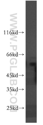 SLC18A1 Antibody in Western Blot (WB)