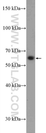 SLC18A1 Antibody in Western Blot (WB)