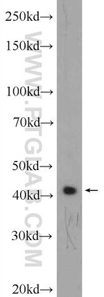 APJ Antibody in Western Blot (WB)