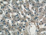 LASS2 Antibody in Immunohistochemistry (Paraffin) (IHC (P))