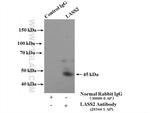 LASS2 Antibody in Immunoprecipitation (IP)