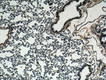 LASS2 Antibody in Immunohistochemistry (Paraffin) (IHC (P))