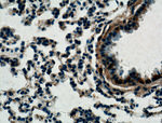 LASS2 Antibody in Immunohistochemistry (Paraffin) (IHC (P))