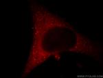 FGD3 Antibody in Immunocytochemistry (ICC/IF)